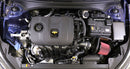 AEM C.A.S. 19-20 Kia Forte 2.0L F/I Cold Air Intake-2