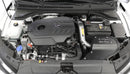 AEM C.A.S 19-20 Hyundai Veloster N 2.0T F/I Cold Air Intake System-2