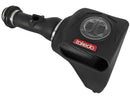 aFe Takeda Momentum GT Pro DRY S Cold Air Intake System 17-18 Honda Civic Si I4 1.5L (t)-1